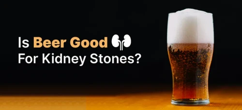 beer kidney stones